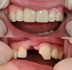 Naša práca - mostík na sklennom vlákne