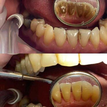 hygiena
